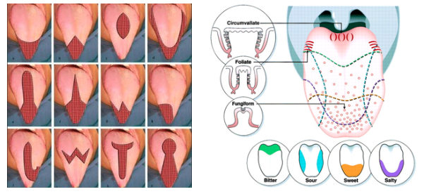 Image result for complications of Tongue reduction surgery